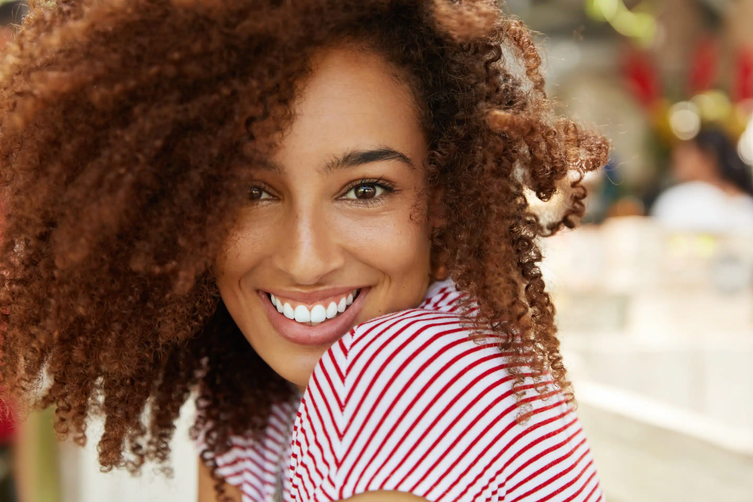 Dental Whitening at Dentist in Greenville, SC
