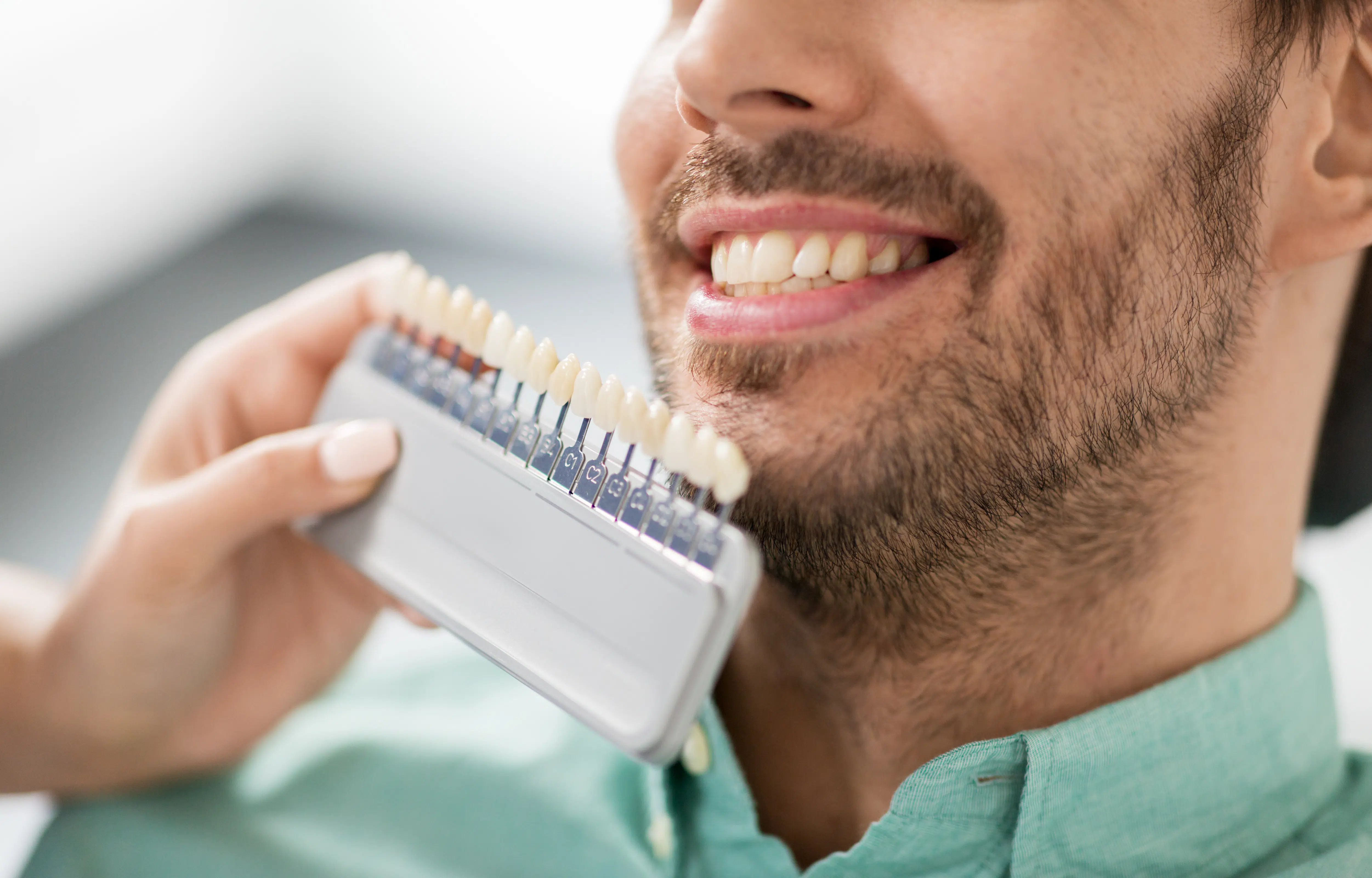 Porcelain Veneers